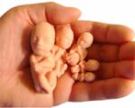 Medicīniskā aborta metode: ieteikumi un ierobežojumi